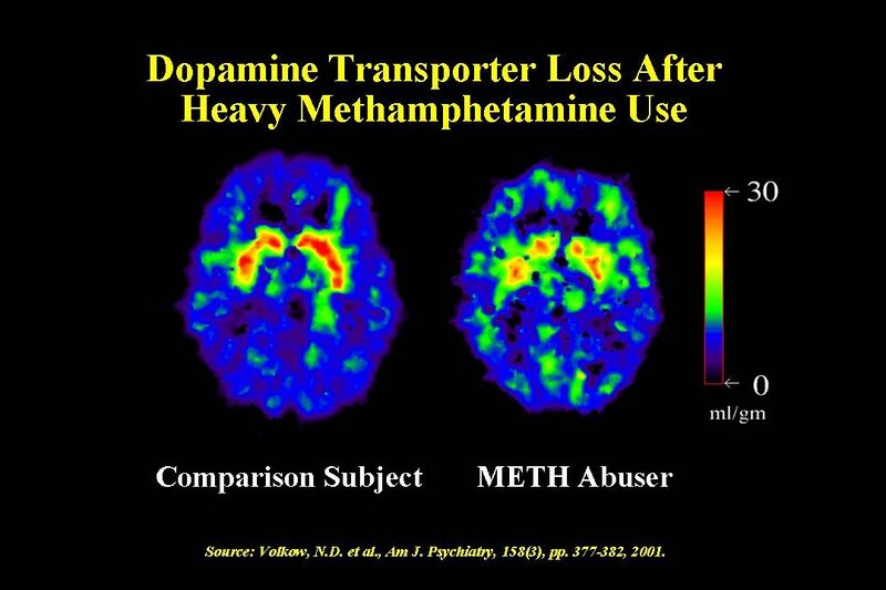 File:Dopamine Transporter Meth.jpg