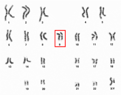 Human male karyotpe high resolution - Chromosome 9.png
