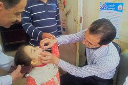 A child receiving drops of polio vaccine in her mouth