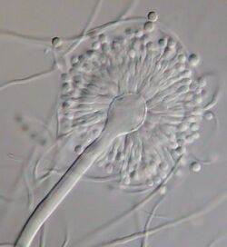 Aspergillus versicolor.jpeg