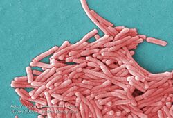 Legionella pneumophila (SEM).jpg