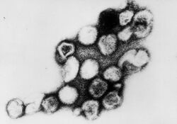 Transmission electron micrograph of Rubella virus virions
