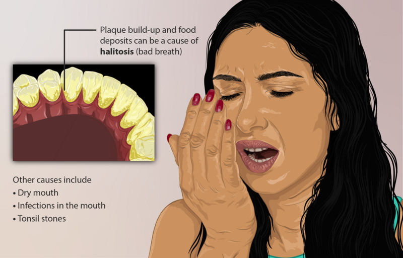 File:Depiction of a person who has Halitosis (or bad breath).png