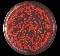 Serratia marcescens.jpg