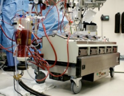 It is a machine to oxygenate the blood and remove the carbon dioxide during the cardiac operation