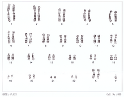 Human chromosomesXXY01.png