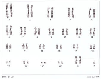 Human chromosomesXXY01.png