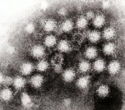 Transmission electron micrograph of Norovirus particles in feces