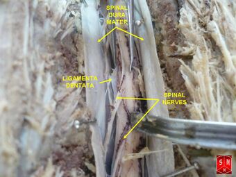 Dissection of spinal cord.jpg