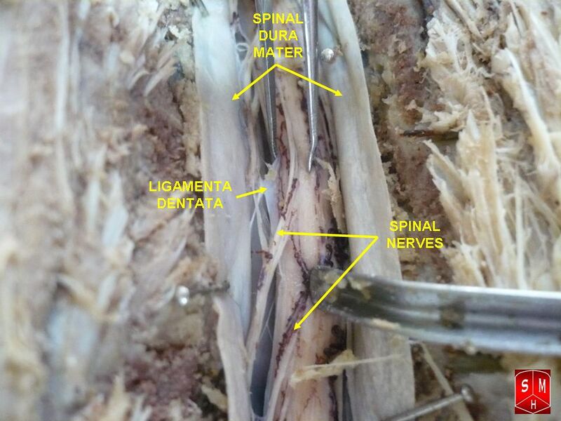 File:Dissection of spinal cord.jpg