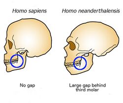 Retromolar gap.jpg