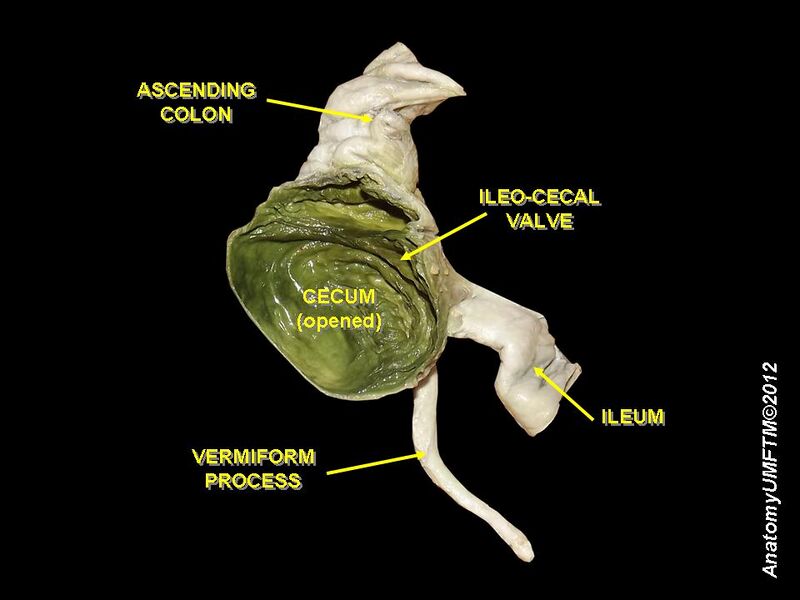 File:Cecum and ileocecal valve.JPG