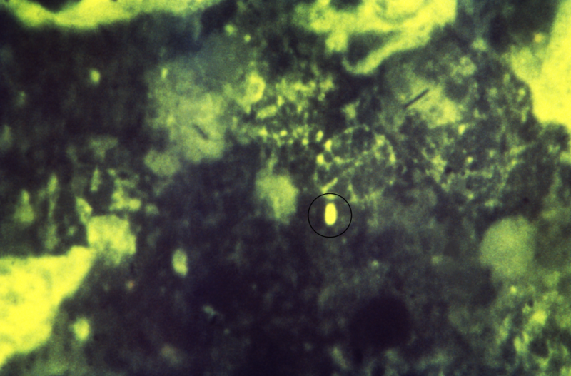 File:Immunofluorescent-stained sample of guinea pig tissue leads to positive diagnosis of melioidosis.png