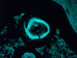 Natural luminescence of corpora amylacea of prostate.jpg