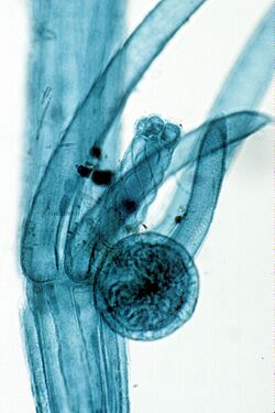 Light micrograph of a whole-mount slide of an oogonium and antheridium of Chara