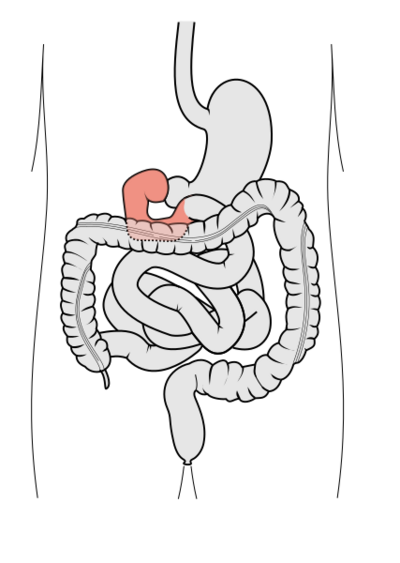 File:Tractus intestinalis duodenum.svg
