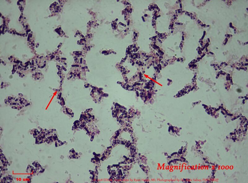 File:Bacillus flexus.jpg