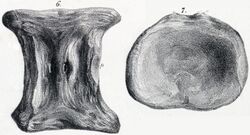 Drawing of a vertebra from two angles