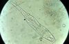 Rotifera (Genusː Philodina) - 40X view.jpg