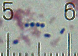 20101210 020132 StreptococcusThermophilus.jpg