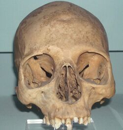 Skull of Khety.jpg