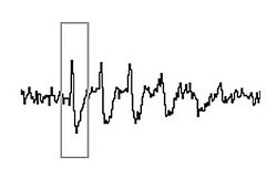 A jagged line with upward-downward deflections. A rectangular box surrounds one deflection.