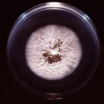 White, powdery colony on Petri dish