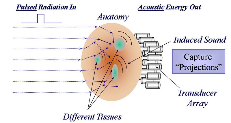 File:Thermoacoustic Imaging Approach.jpg