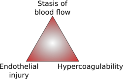 Virchow's Triad.svg