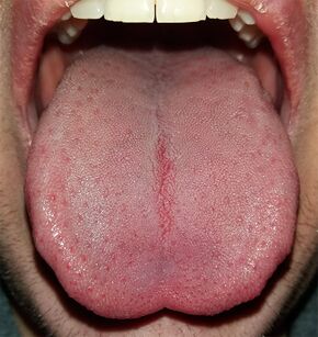 زبان tongue.jpg