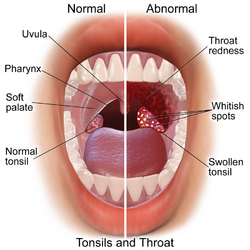 Blausen 0860 Tonsils&Throat Anatomy.png