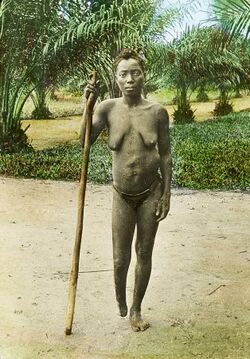 Female atrocity victim, Congo, ca. 1900-1915 (IMP-CSCNWW33-OS10-22).jpg