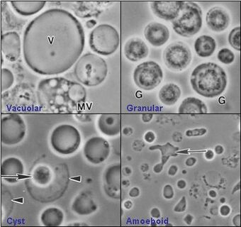 Four common forms of Blastocystis hominis Valzn.jpg