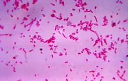 "Fusobacterium novum" in liquid culture