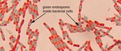 OSC Microbio 02 04 Endospores.jpg