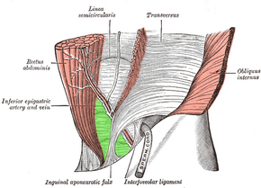 Inguinal triangle, external view.png