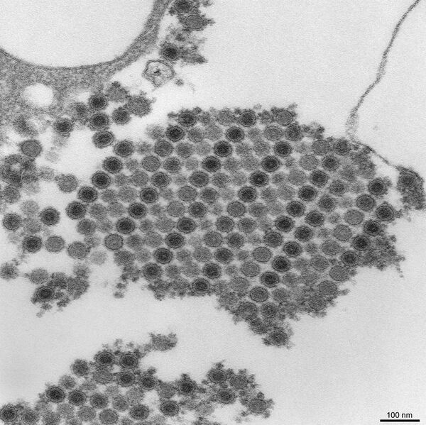 File:Chikungunya virus particles-PHIL-17369.jpg