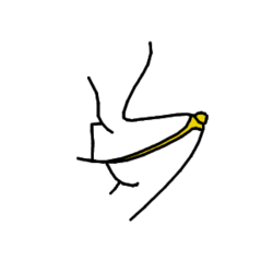 The image shows a drawing of a small portion of the edge of a leaf bearing a salicoid tooth. Black veins cross the leaf surface, but one vein is marked yellow and widens as it approaches the tooth. At the tip of the tooth is a semicircular protuberance, also drawn as yellow for emphasis.