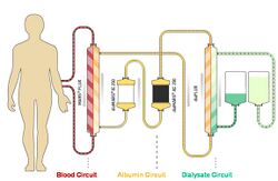 Albumin dialysis circuit.jpg