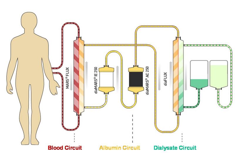 File:Albumin dialysis circuit.jpg