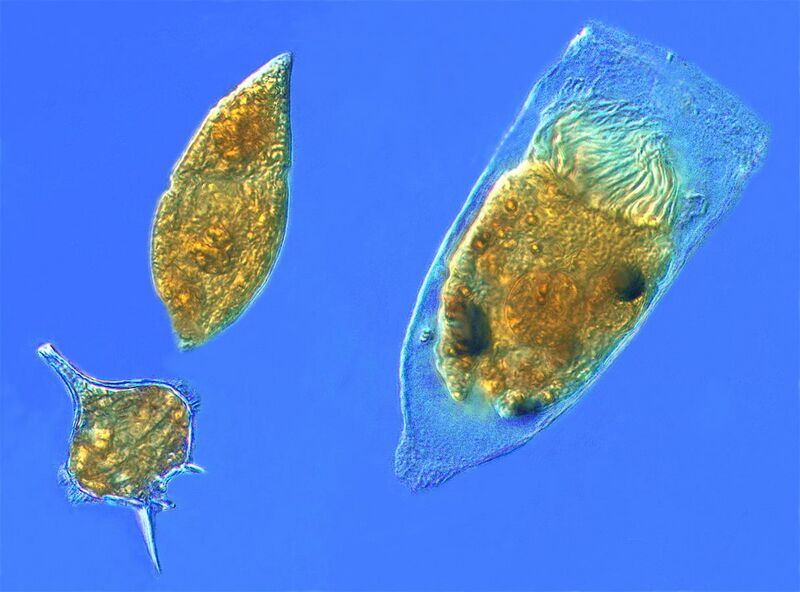 File:Dinoflagellates and a tintinnid ciliate.jpg