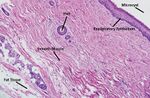Histopathology of ovarian dermoid cyst.jpg