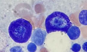 Mast cells in bone marrow.jpg
