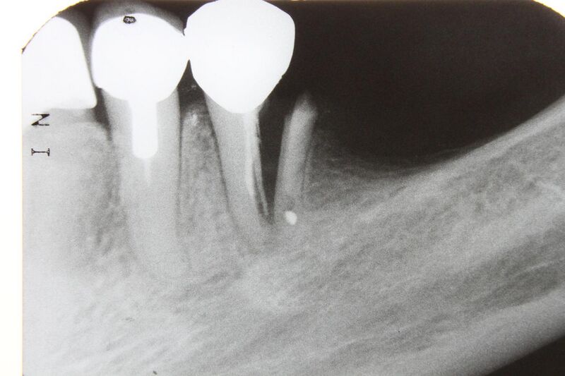 File:Dental x-rays 2010 pd 009.JPG