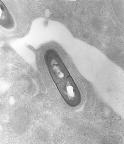 Listeria monocytogenes 01.jpg