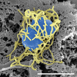 Scanning electron micrograph of a single "N. meningitidis" cell (colorized in blue) with its adhesive pili (colorized in yellow). The scale bar corresponds to 1 µm.