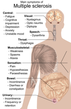 Symptoms of multiple sclerosis.svg