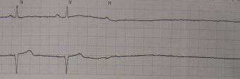 Asystole11.JPG