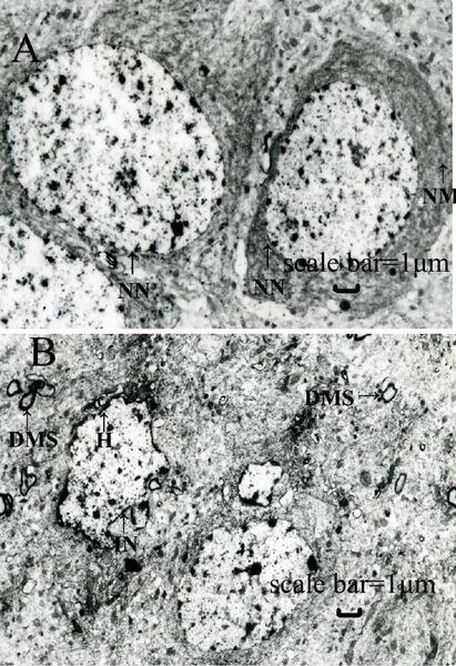 File:Lead-exposed rat hippocampi.jpg