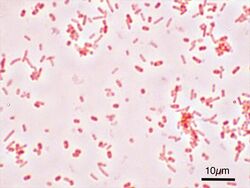 Salmonella Typhimurium Gram.jpg